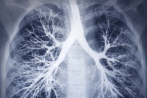 Lungs