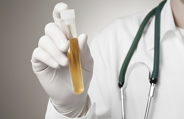 A person holding a urine sample