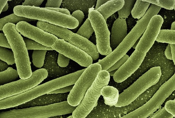 E.coli under a microscope