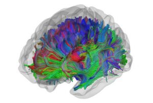 White Matter Tracts
