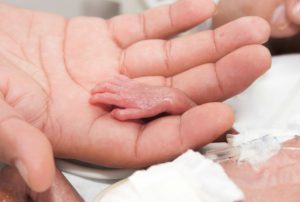 Portrait of newborn baby and hand inside incubator