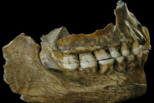 Teeth