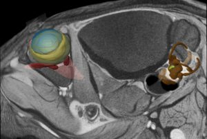 Computational reconstruction of vestibular system