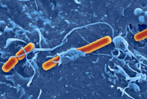 Shigella flexneri