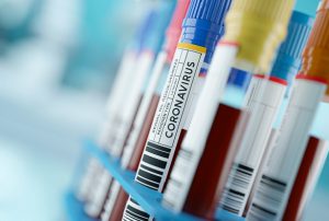 A close up shot of Coronavirus 2019-nCoV an infectious flu virus which causes respiratory illness. Human blood samples in a medical lab. 3d illustration concept.