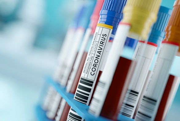 Coronavirus 2019-nCoV Blood Samples Medical Concept