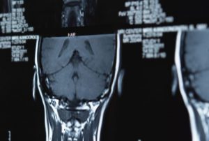 Medical scan of head and neck area