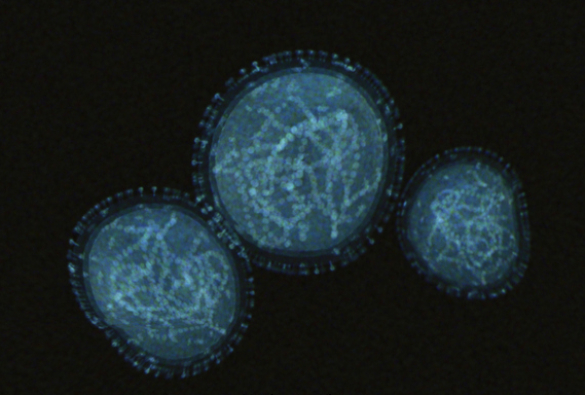 Monkeypox virus particles under the microscope