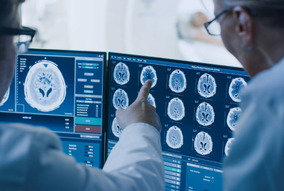 Doctors review brain scans